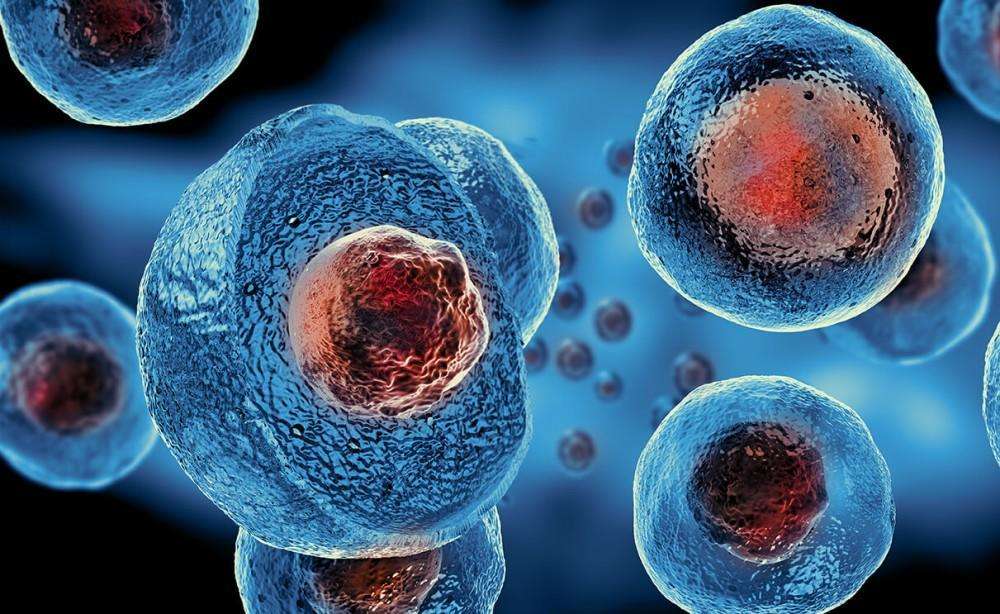 Células madre para la artrosis de rodilla: qué dice la evidencia